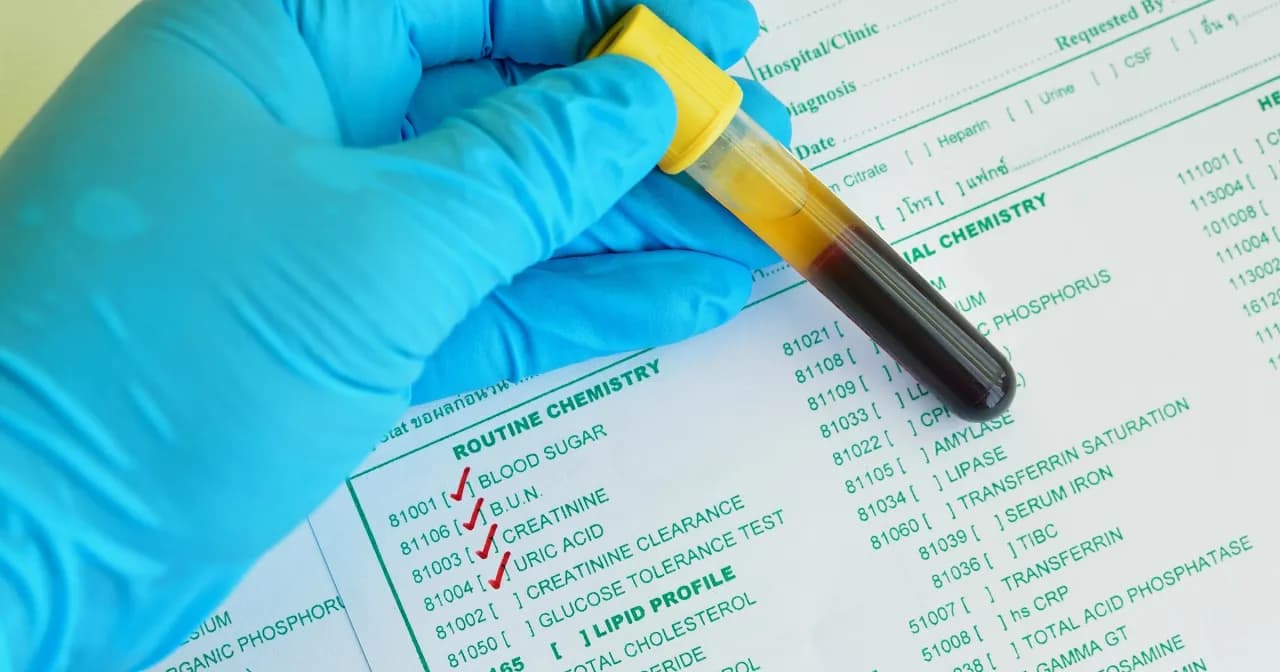 Kreatynina z czego badanie? Poznaj kluczowe informacje o testach nerkowych