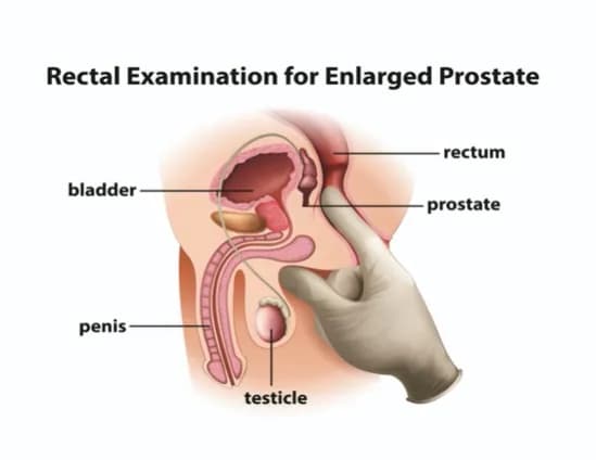 Czy badanie przez odbyt boli? Poznaj prawdę o tym badaniu