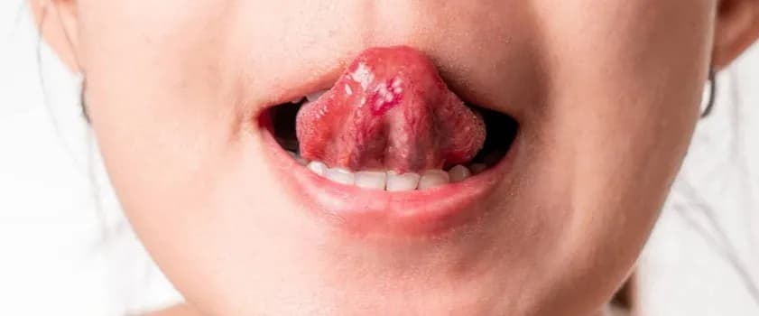 Choroby języka jaki lekarz – kiedy szukać pomocy specjalisty?