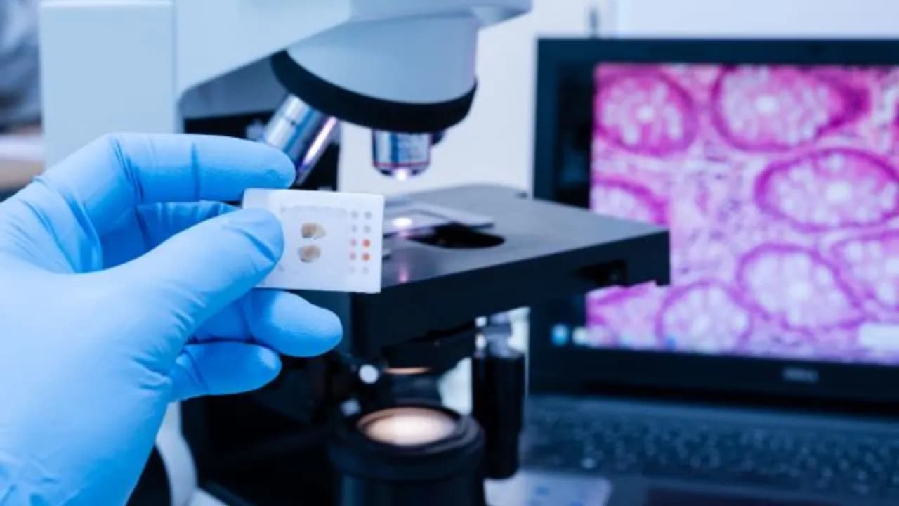 Na czym polega badanie histopatologiczne i jak ratuje życie pacjentów